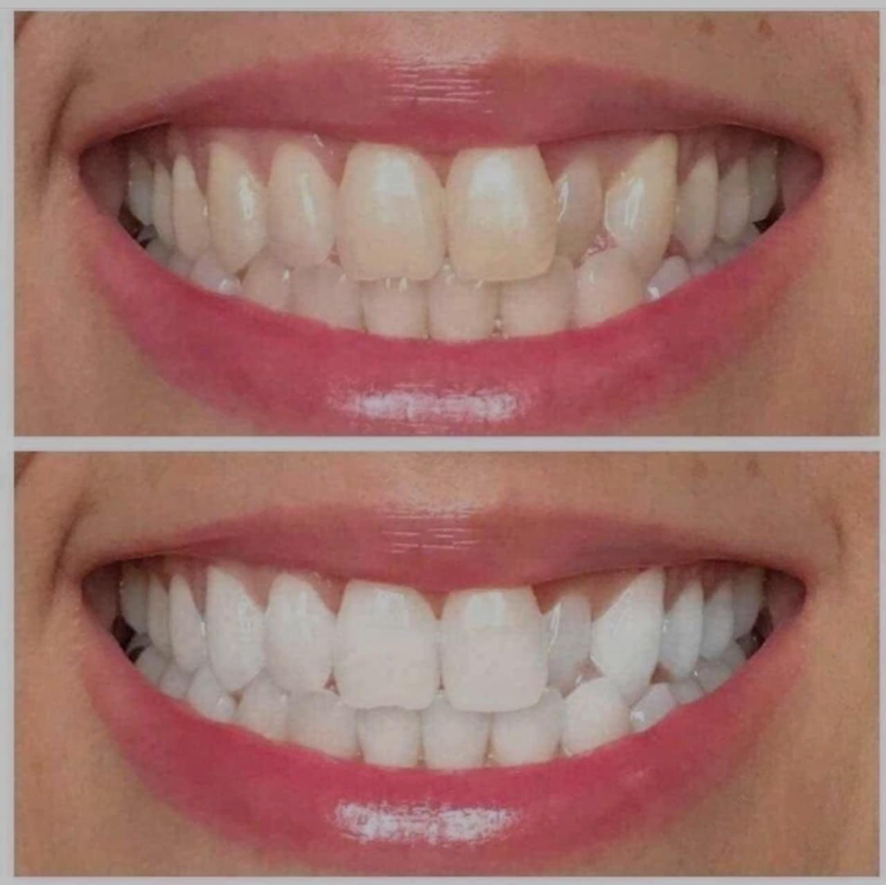 Ultraviolet Pearly Whites Brightening Gel  - RESTOCK!